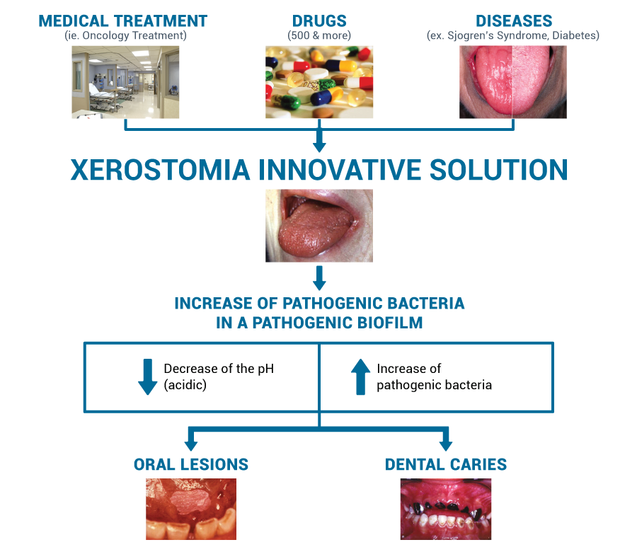 Xerostomia Oral Science