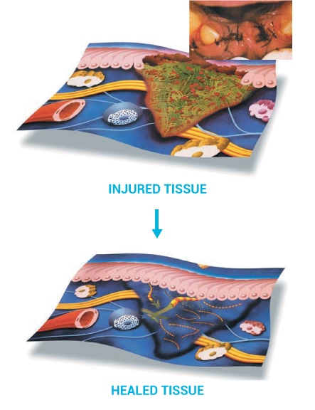 illustation of injured and healed tissue