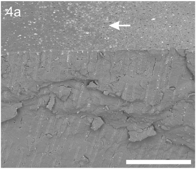 aarrest-gel-figure4-a Fig. 4a shows slightly more abundant SDF precipitates on dentine surface following application of Advantage Arrest® Gel.