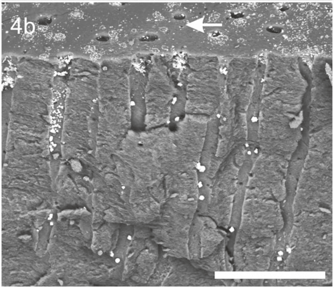 aarrest-gel-figure4-b Fig. 4b shows slightly more abundant SDF precipitates on dentine surface following application of Advantage Arrest® Gel.