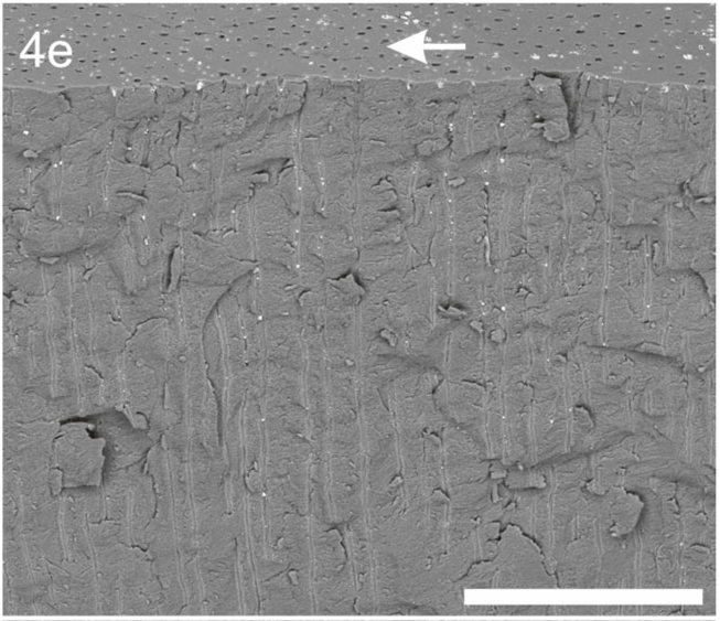 aarrest-gel-figure4-e Fig. 4e shows SDF precipitates on dentine surface following application of Advantage Arrest® Liquid formula.