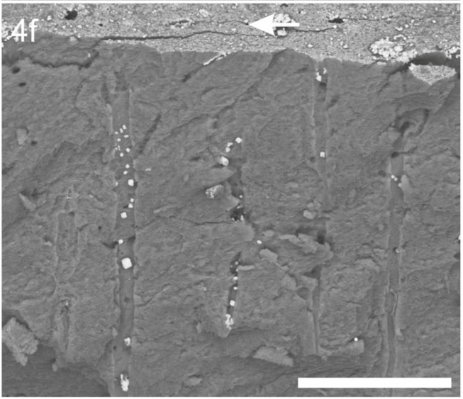 aarrest-gel-figure4-f Fig. 4f shows SDF precipitates on dentine surface following application of Advantage Arrest® Liquid formula.