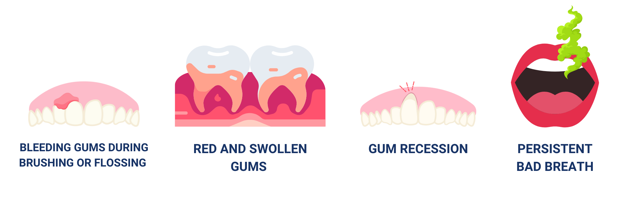 gingivitis symptoms